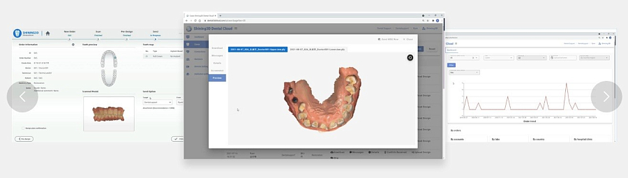 Интраоральный сканер Aoralscan L (LUX, полное ПО) - Фото 12